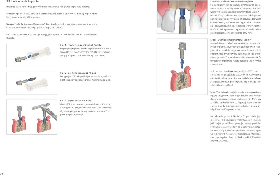 Uwaga: Implanty Stożkowe Straumann Bone Level muszą być pozycjonowane na etapie wkręcania zarówno mechanicznego, jak i Raczetą (patrz krok 4).