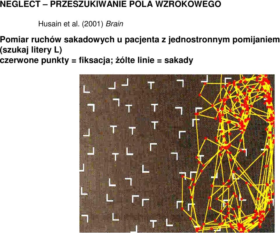 pacjenta z jednostronnym pomijaniem (szukaj