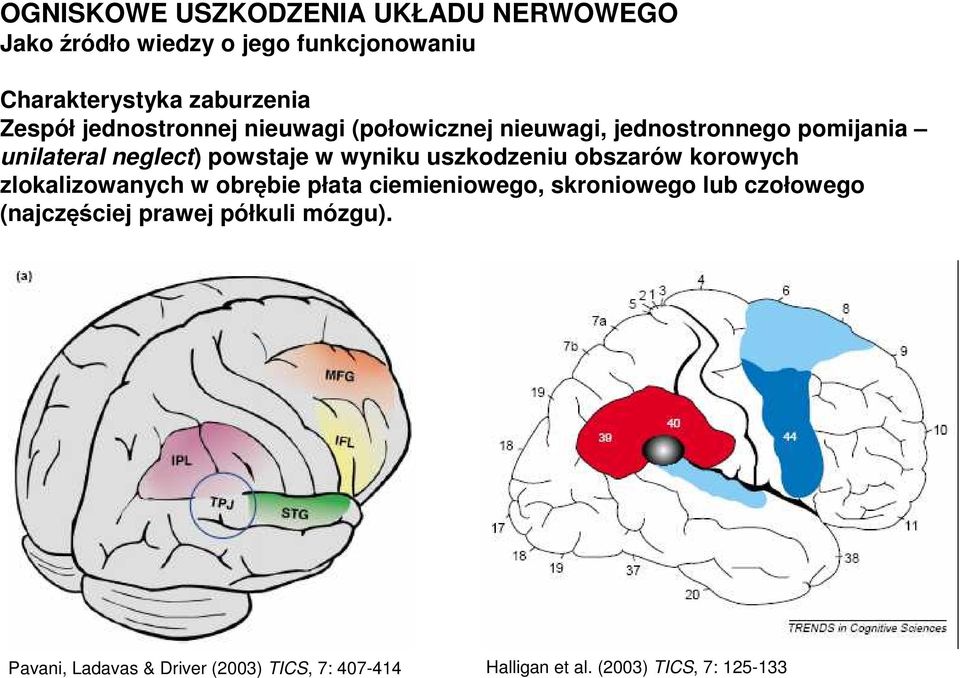 wyniku uszkodzeniu obszarów korowych zlokalizowanych w obrębie płata ciemieniowego, skroniowego lub czołowego