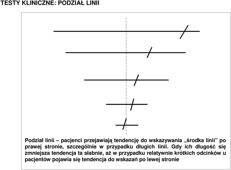 Podział linii pacjenci przejawiają tendencję do wskazywania środka linii po prawej stronie, szczególnie w przypadku długich