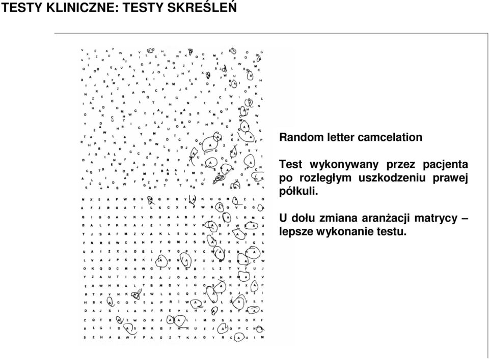 rozległym uszkodzeniu prawej półkuli.