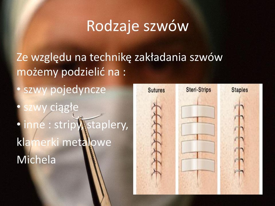 szwy pojedyncze szwy ciągłe inne :