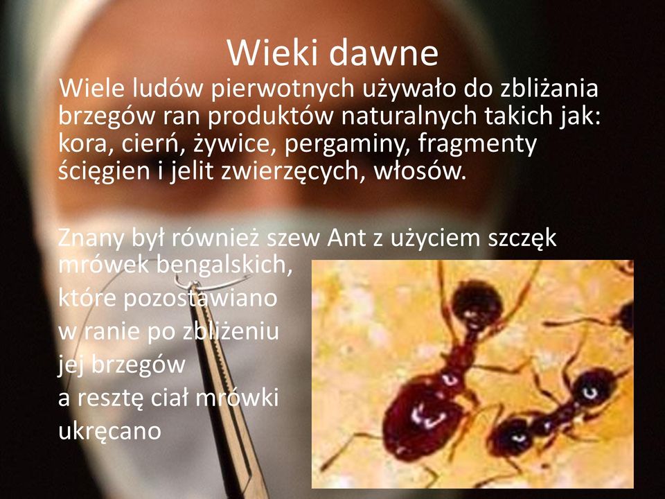 jelit zwierzęcych, włosów.