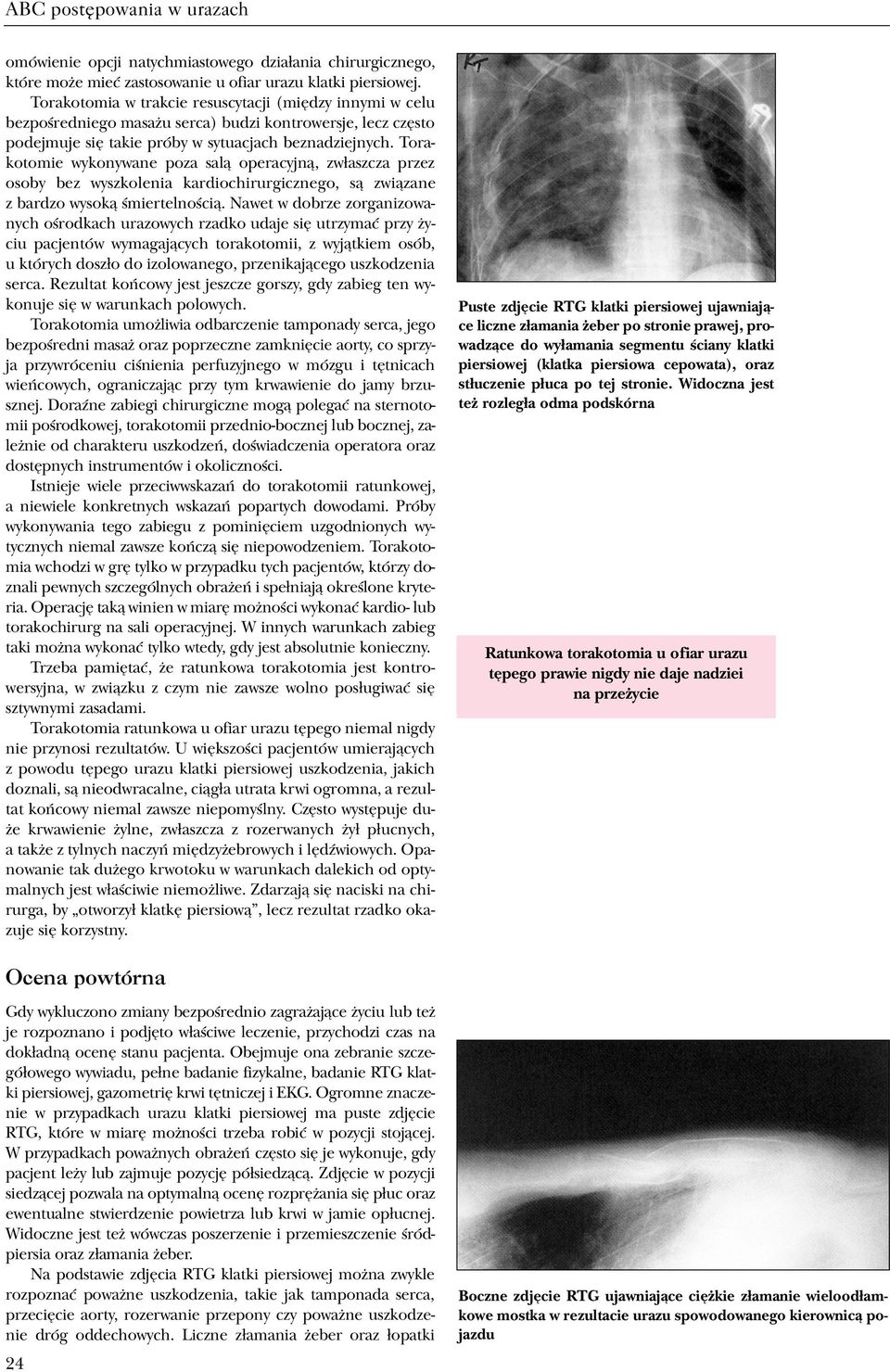 Torakotomie wykonywane poza sal¹ operacyjn¹, zw³aszcza przez osoby bez wyszkolenia kardiochirurgicznego, s¹ zwi¹zane z bardzo wysok¹ œmiertelnoœci¹.