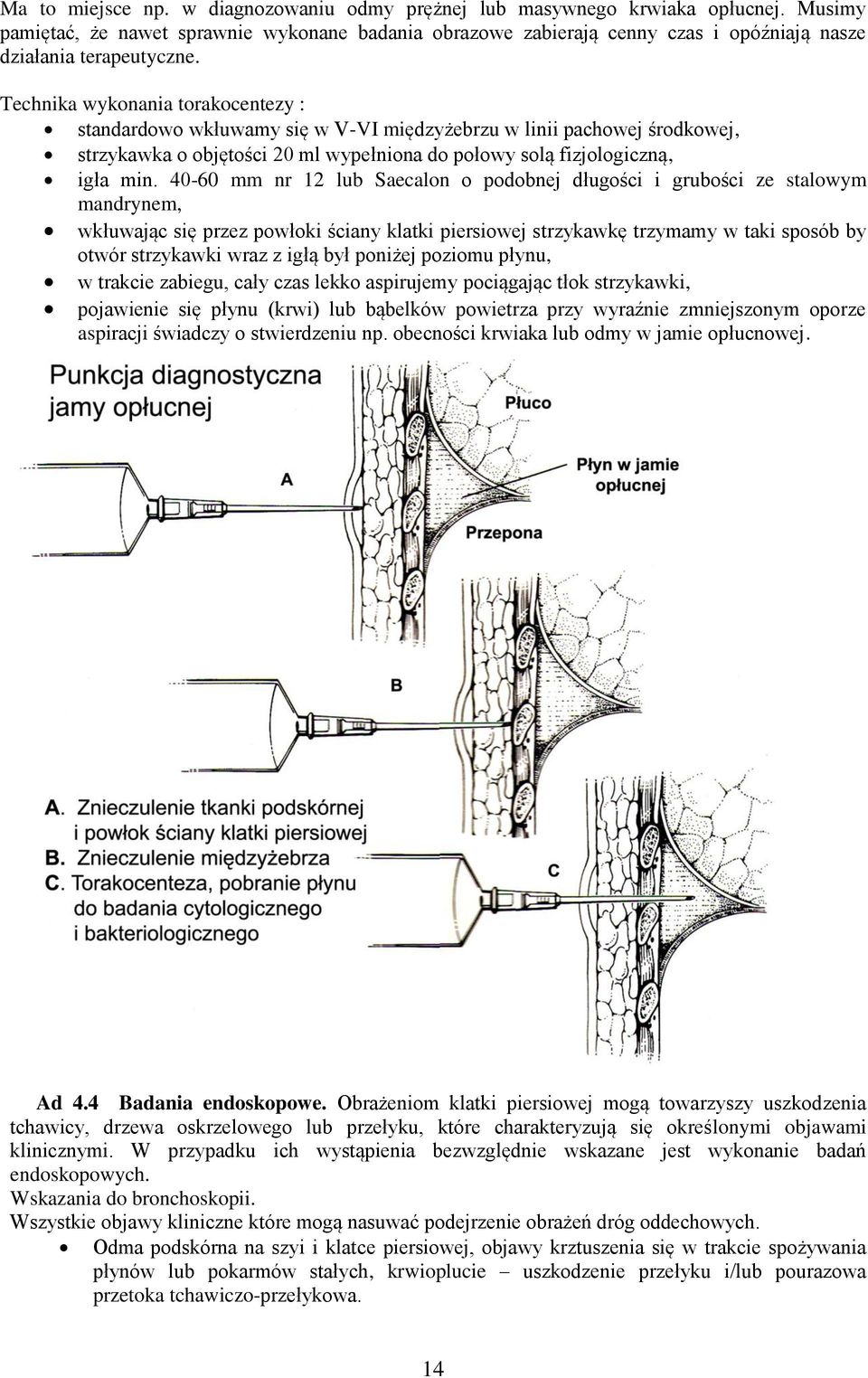 Technika wykonania torakocentezy : standardowo wkłuwamy się w V-VI międzyżebrzu w linii pachowej środkowej, strzykawka o objętości 20 ml wypełniona do połowy solą fizjologiczną, igła min.