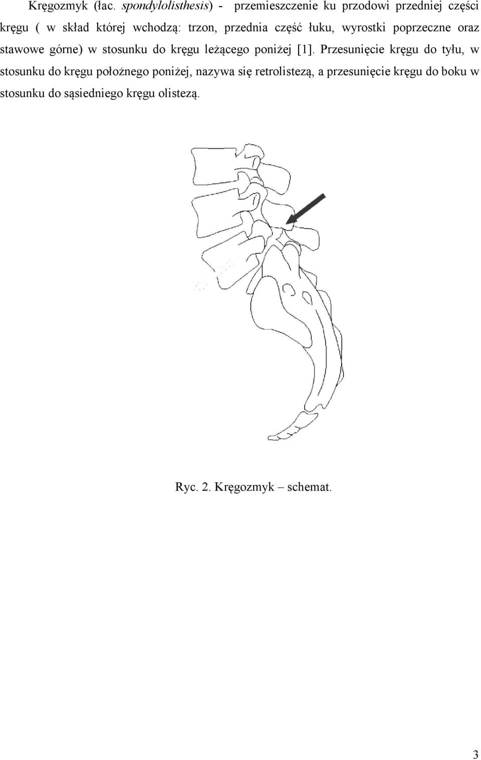 trzon, przednia część łuku, wyrostki poprzeczne oraz stawowe górne) w stosunku do kręgu leżącego