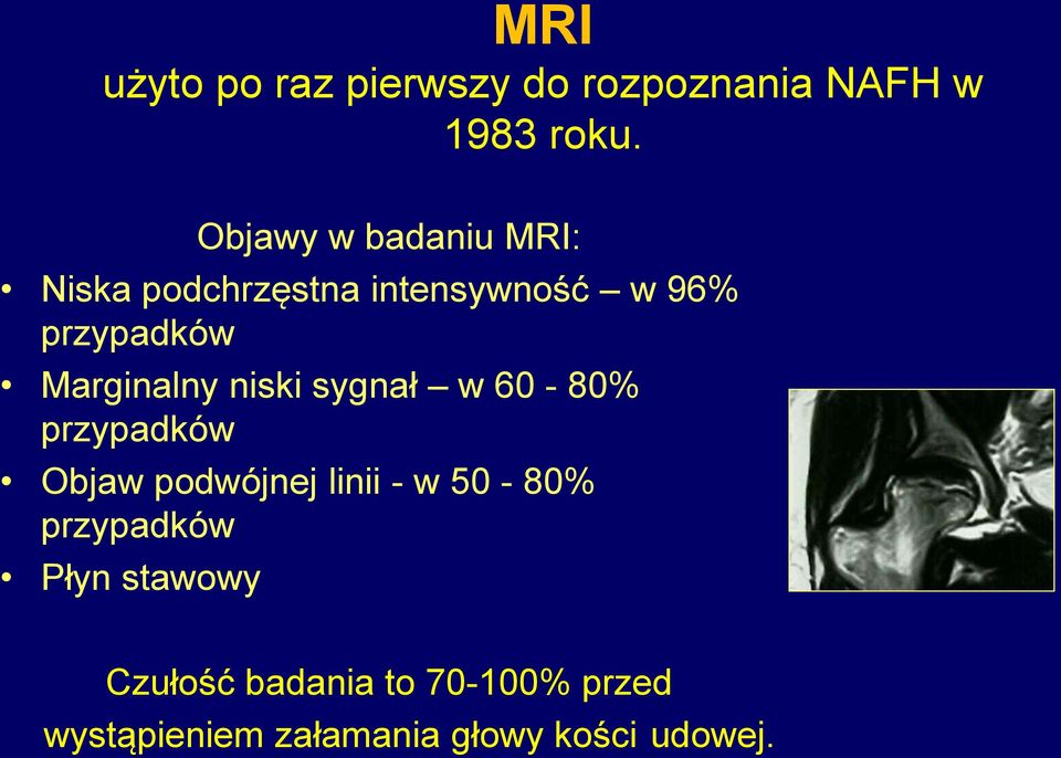 Marginalny niski sygnał w 60-80% przypadków Objaw podwójnej linii - w 50-80%