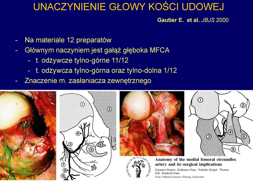 jest gałąź głęboka MFCA - t. odżywcze tylno-górne 11/12 - t.