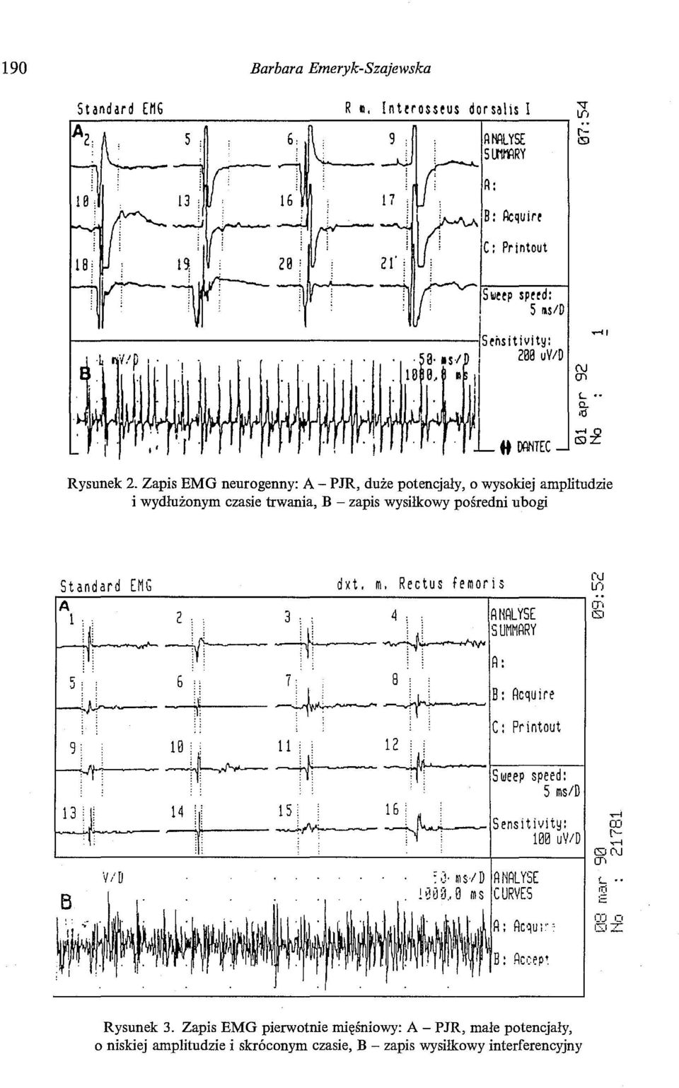 8 ; ' r--:.~. 1 ( ~~B: Acquire C: Printout 9 : 10; ' 11 : : 12 ; : 1--..._:_.Nr-.;...: --~ --f--- -W_,.---~ Sweep speed: 5 ms/d 14 " 15 ' 16; ;..-l 2JL- lll,.c_~~- --..}.