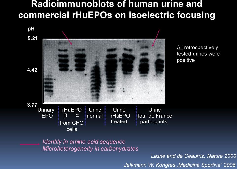 77 Urinary rhuepo EPO b from CHO cells Urine normal Urine rhuepo treated Urine Tour de France