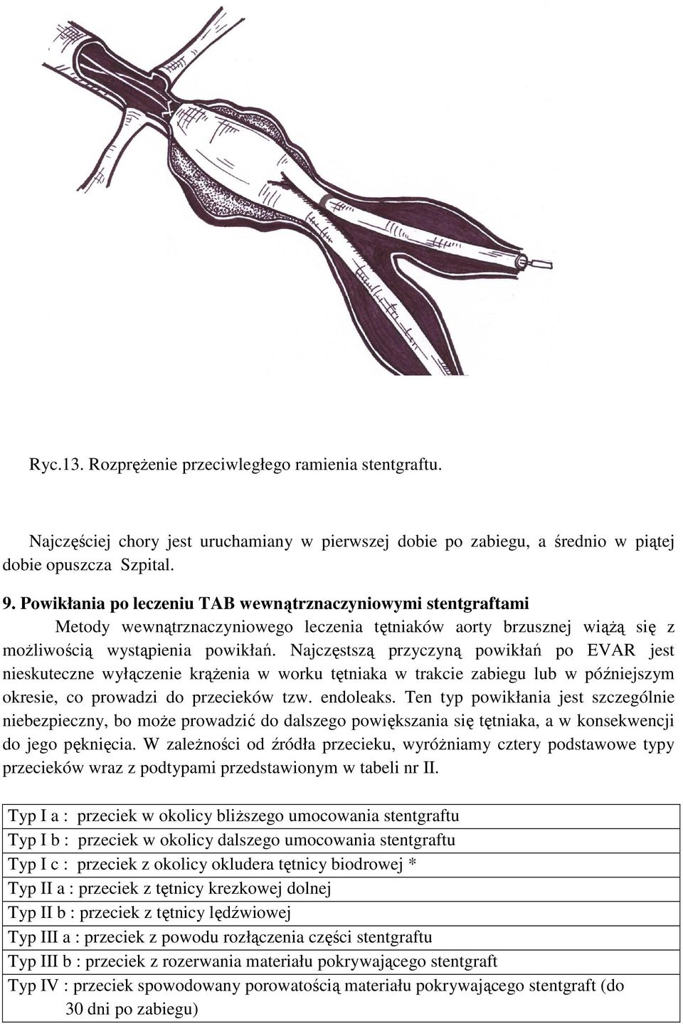 Najczęstszą przyczyną powikłań po EVAR jest nieskuteczne wyłączenie krąŝenia w worku tętniaka w trakcie zabiegu lub w późniejszym okresie, co prowadzi do przecieków tzw. endoleaks.