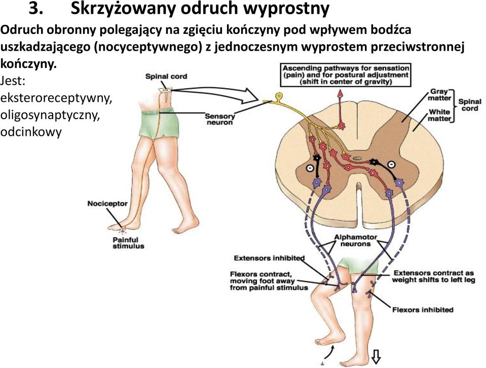 (nocyceptywnego) z jednoczesnym wyprostem przeciwstronnej