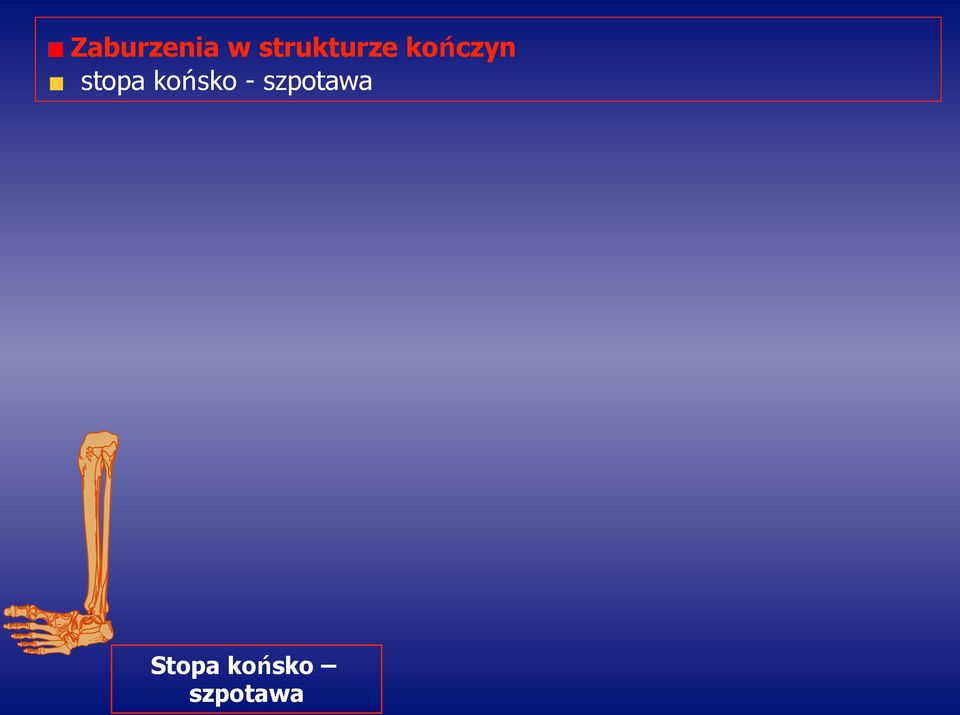 stopa końsko -