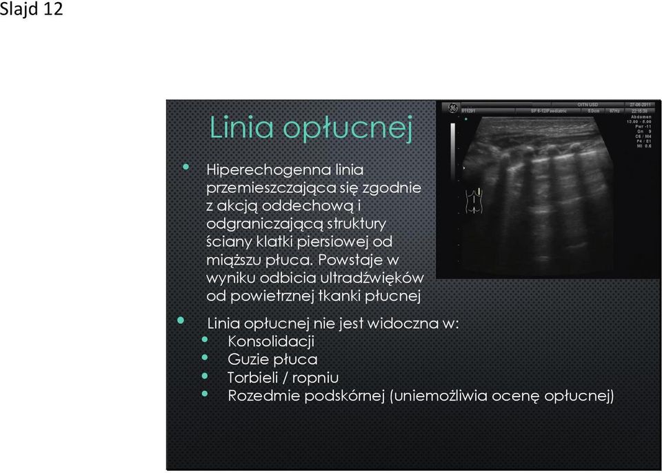 Powstaje w wyniku odbicia ultradźwięków od powietrznej tkanki płucnej Linia opłucnej nie