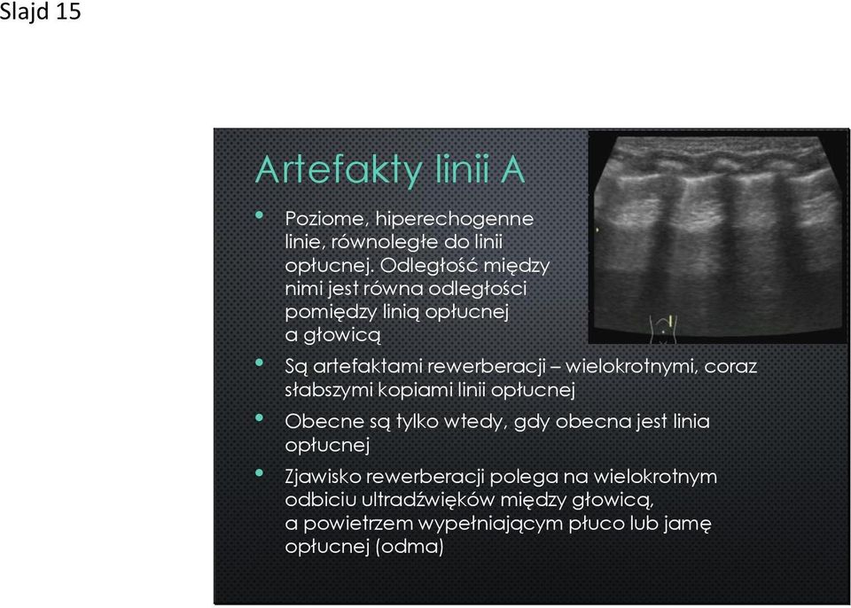 wielokrotnymi, coraz słabszymi kopiami linii opłucnej Obecne są tylko wtedy, gdy obecna jest linia opłucnej