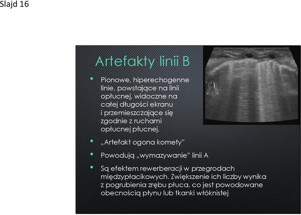 Artefakt ogona komety Powodują wymazywanie linii A Są efektem rewerberacji w przegrodach