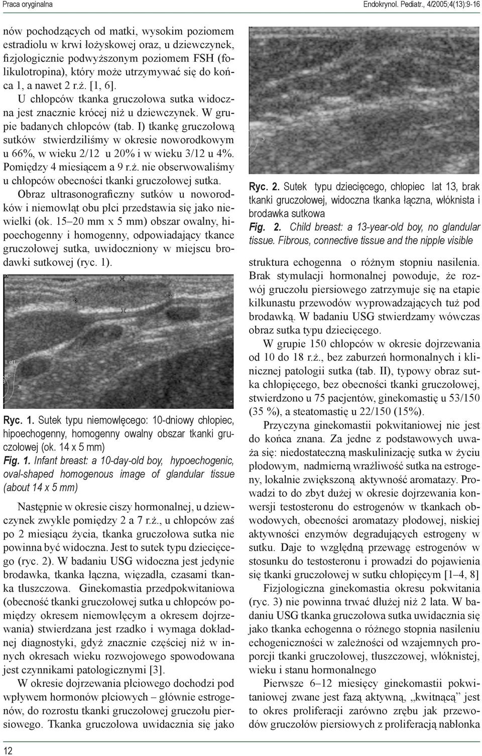 do końca 1, a nawet 2 r.ż. [1, 6]. U chłopców tkanka gruczołowa sutka widoczna jest znacznie krócej niż u dziewczynek. W grupie badanych chłopców (tab.