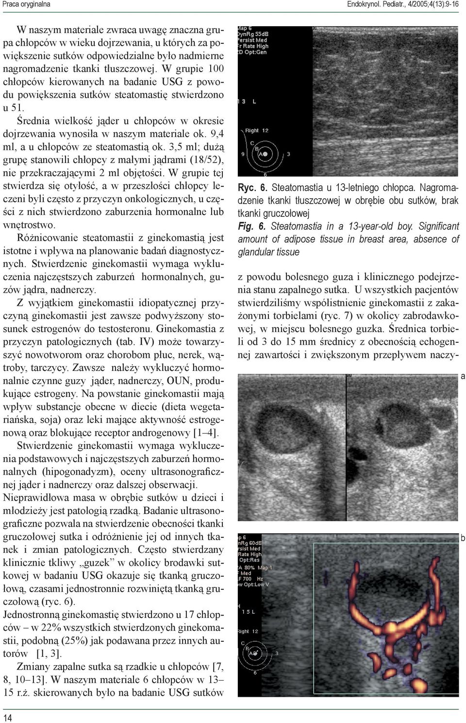W grupie 100 chłopców kierowanych na badanie USG z powodu powiększenia sutków steatomastię stwierdzono u 51. Średnia wielkość jąder u chłopców w okresie dojrzewania wynosiła w naszym materiale ok.