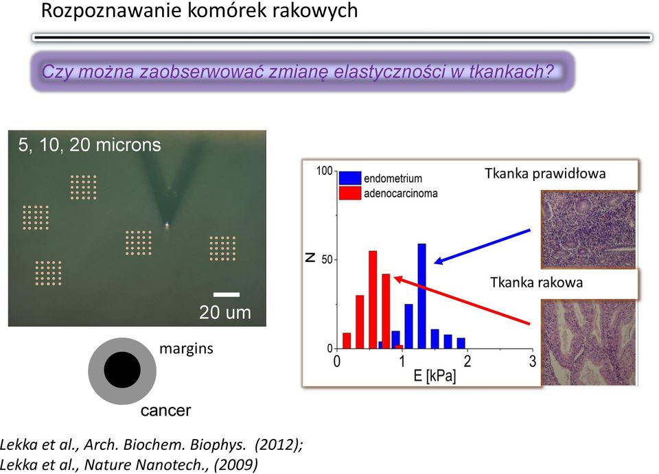 5, 10, 20 microns margins 20 um cancer Lekka et al.