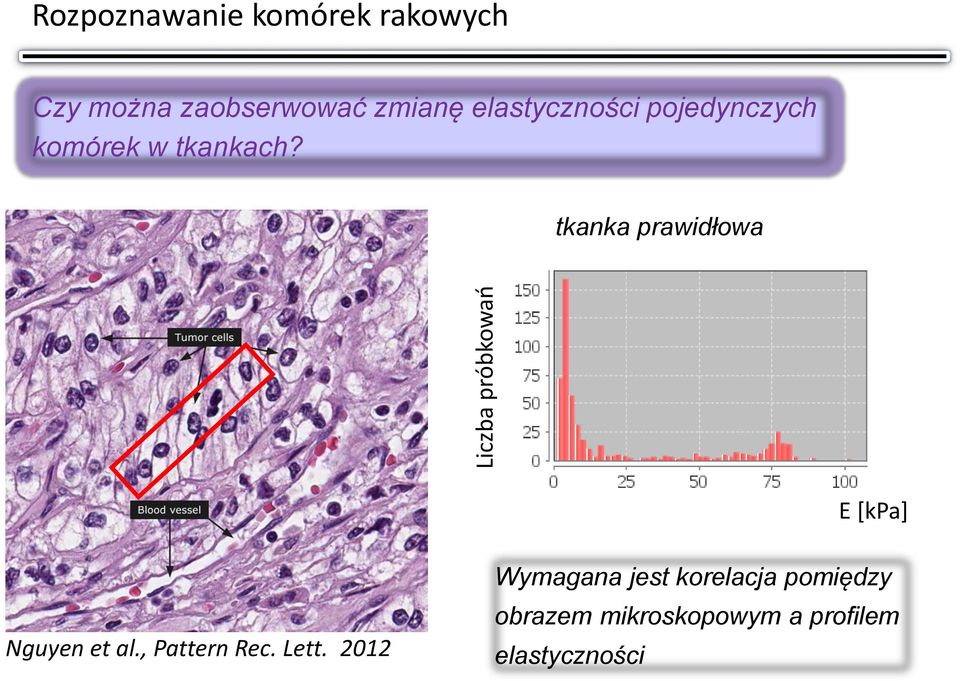 tkanka prawidłowa E [kpa] Nguyen et al., Pattern Rec. Lett.