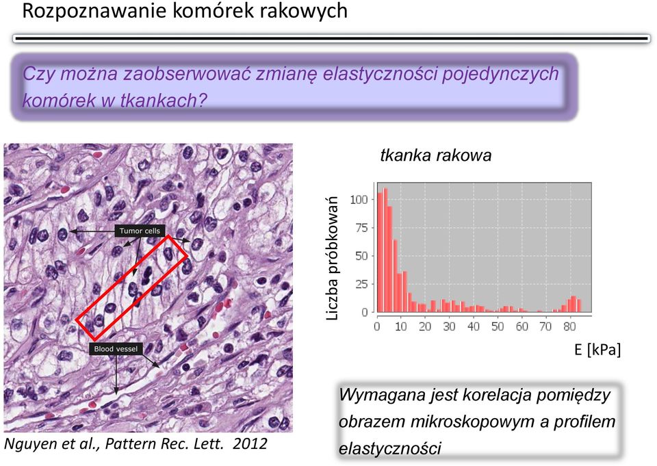 tkanka rakowa E [kpa] Nguyen et al., Pattern Rec. Lett.