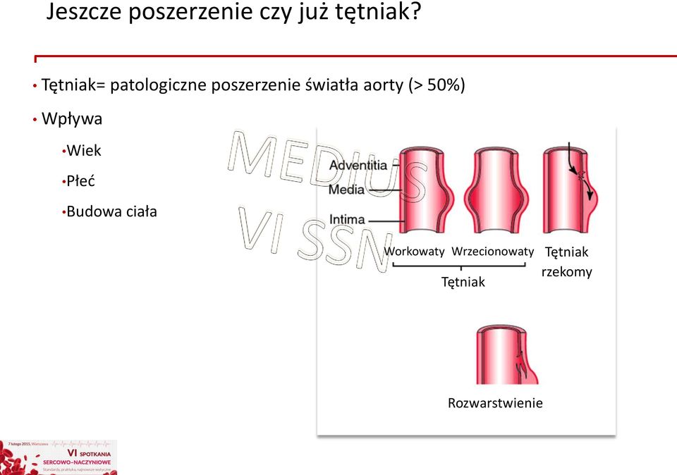 aorty (> 50%) Wpływa Wiek Płeć Budowa ciała