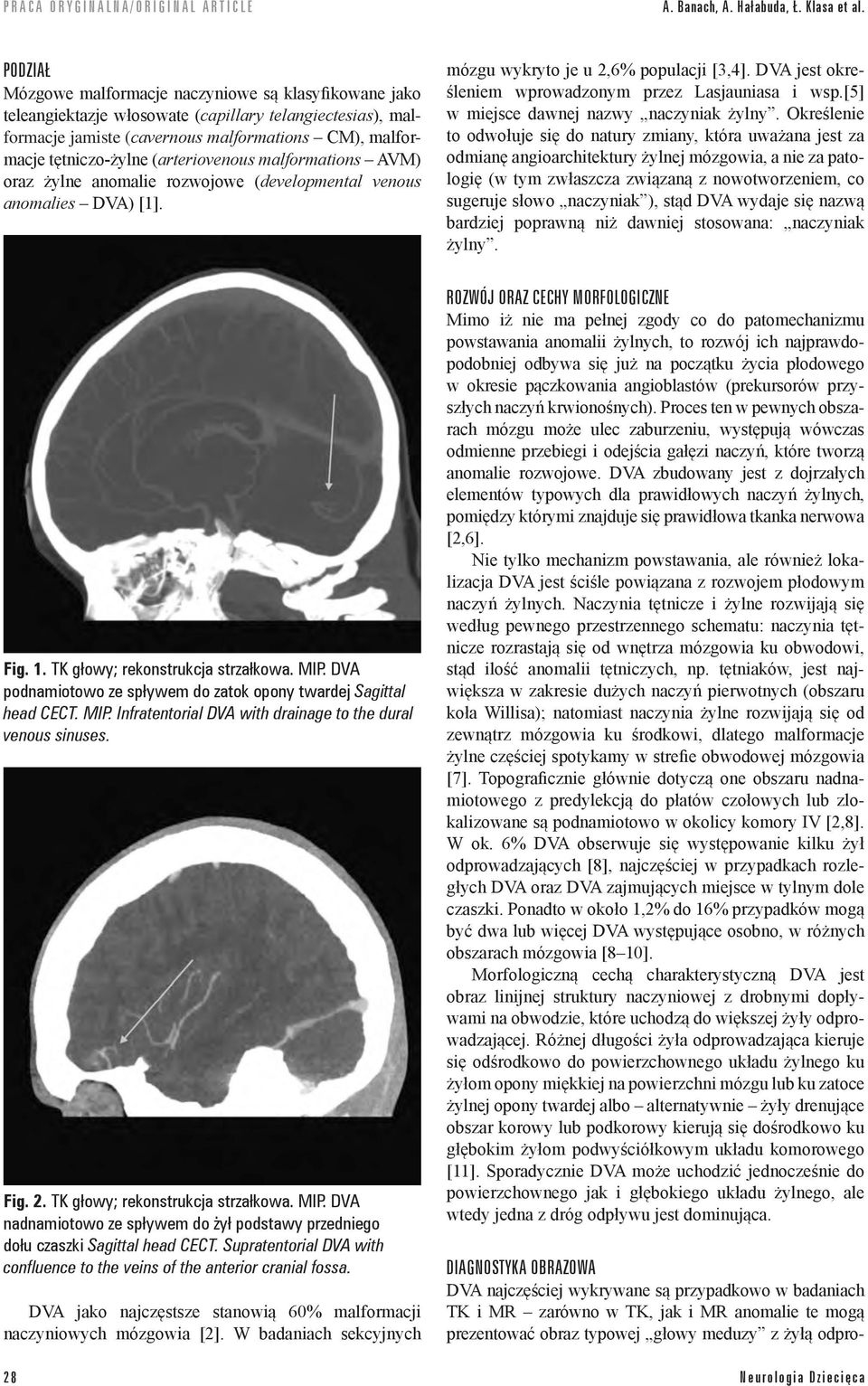 (arteriovenous malformations AVM) oraz żylne anomalie rozwojowe (developmental venous anomalies DVA) [1]. mózgu wykryto je u 2,6% populacji [3,4].