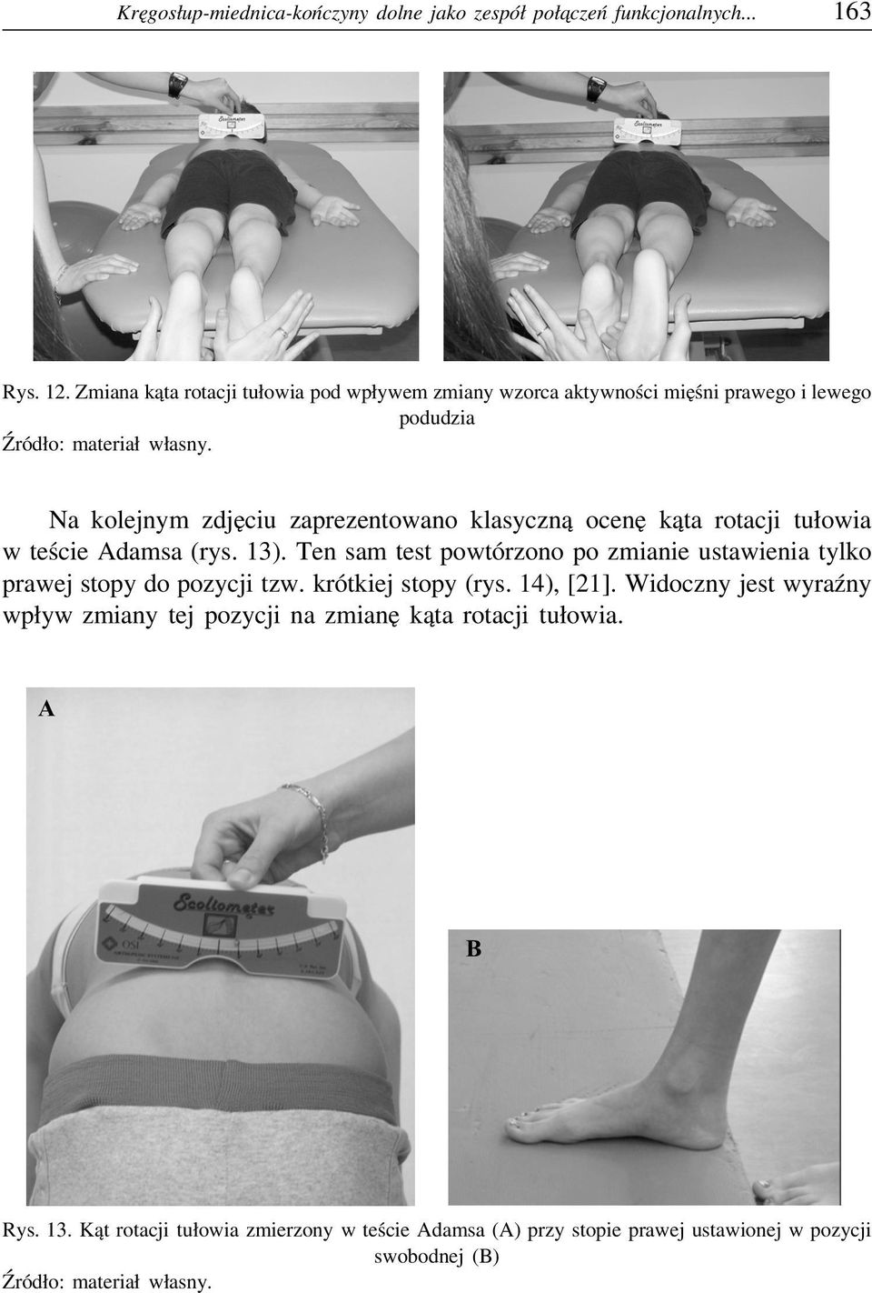 ocenę kąta rotacji tułowia w teście Adamsa (rys. 13). Ten sam test powtórzono po zmianie ustawienia tylko prawej stopy do pozycji tzw.