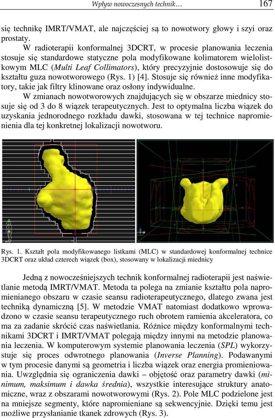 dostosowuje się do kształtu guza nowotworowego (Rys. 1) [4]. Stosuje się również inne modyfikatory, takie jak filtry klinowane oraz osłony indywidualne.