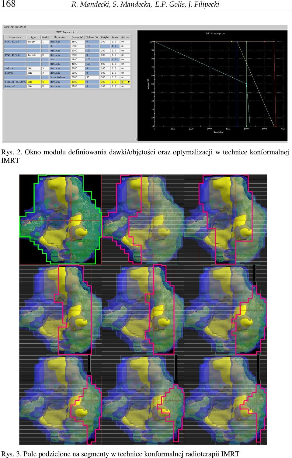 optymalizacji ji w technice konformalnej IMRT Rys. 3.