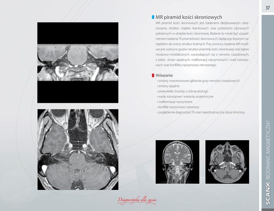 Przy pomocy badania MR możliwe jest wykrycie guzów struktur piramidy kości skroniowej oraz kątów mostowo-móżdżkowych, wywodzących się z nerwów czaszkowych, a także zmian zapalnych, malformacji