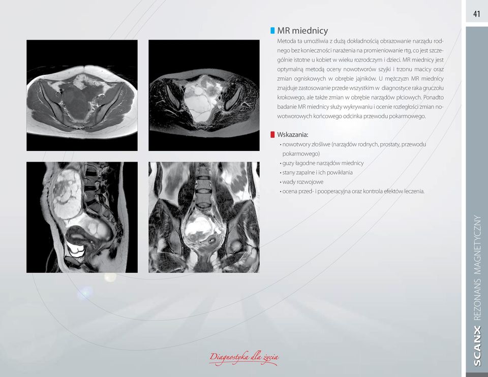 U mężczyzn MR miednicy znajduje zastosowanie przede wszystkim w diagnostyce raka gruczołu krokowego, ale także zmian w obrębie narządów płciowych.