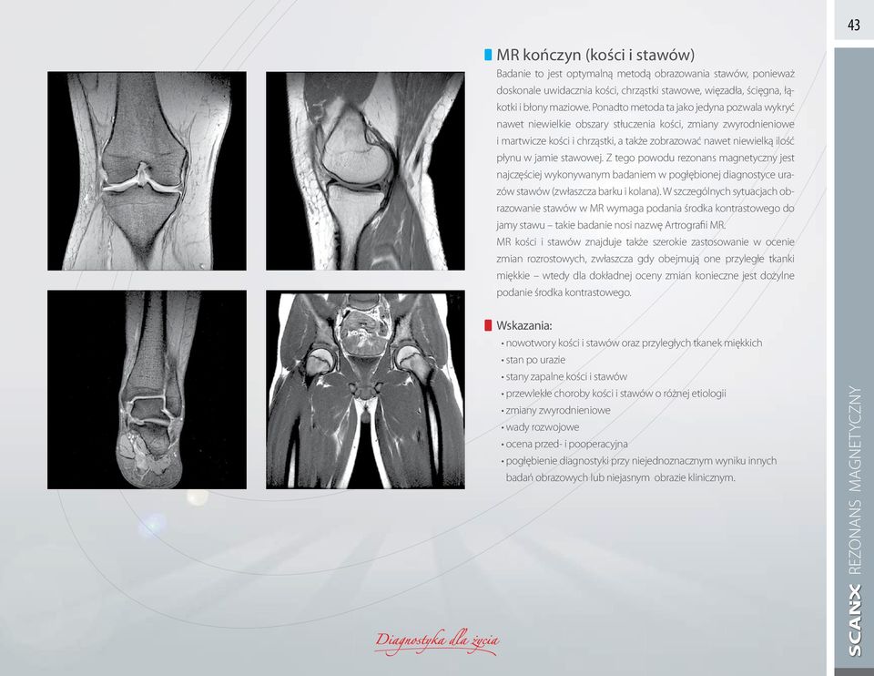 stawowej. Z tego powodu rezonans magnetyczny jest najczęściej wykonywanym badaniem w pogłębionej diagnostyce urazów stawów (zwłaszcza barku i kolana).