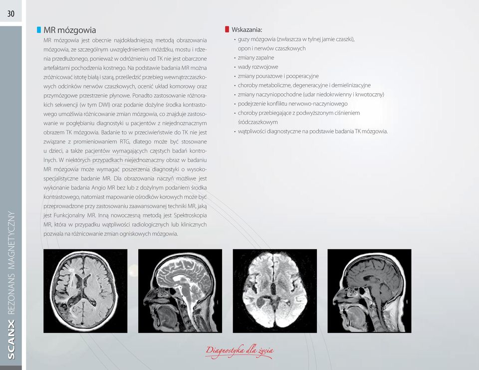 Na podstawie badania MR można zróżnicować istotę białą i szarą, prześledzić przebieg wewnątrzczaszkowych odcinków nerwów czaszkowych, ocenić układ komorowy oraz przymózgowe przestrzenie płynowe.