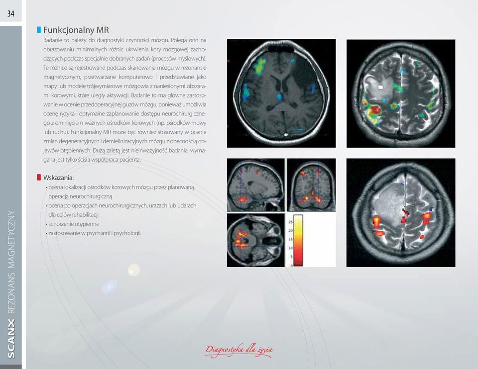 Te różnice są rejestrowane podczas skanowania mózgu w rezonansie magnetycznym, przetwarzane komputerowo i przedstawiane jako mapy lub modele trójwymiarowe mózgowia z naniesionymi obszarami korowymi,