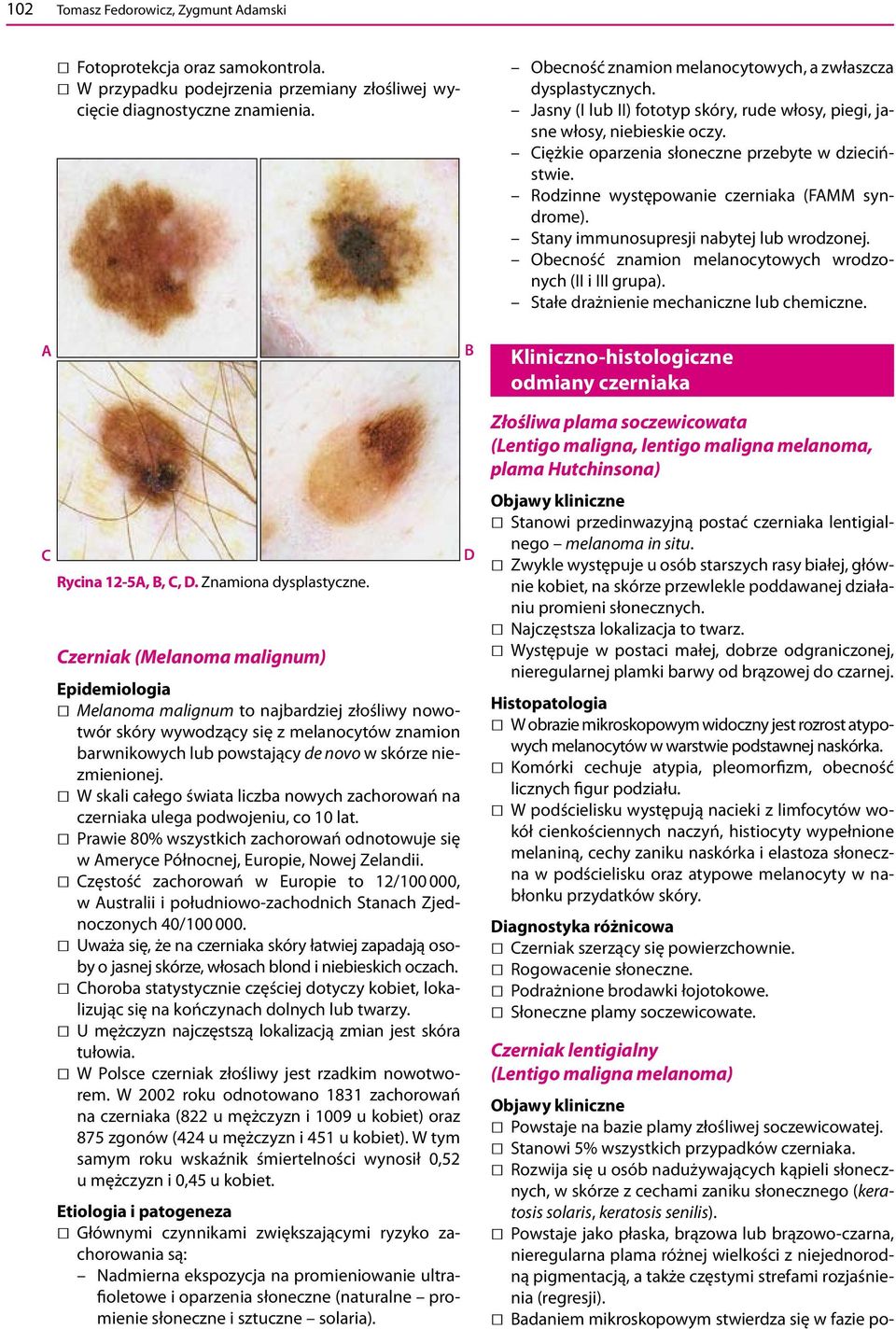 Rodzinne występowanie czerniaka (FMM syndrome). Stany immunosupresji nabytej lub wrodzonej. Obecność znamion melanocytowych wrodzonych (II i III grupa). Stałe drażnienie mechaniczne lub chemiczne.