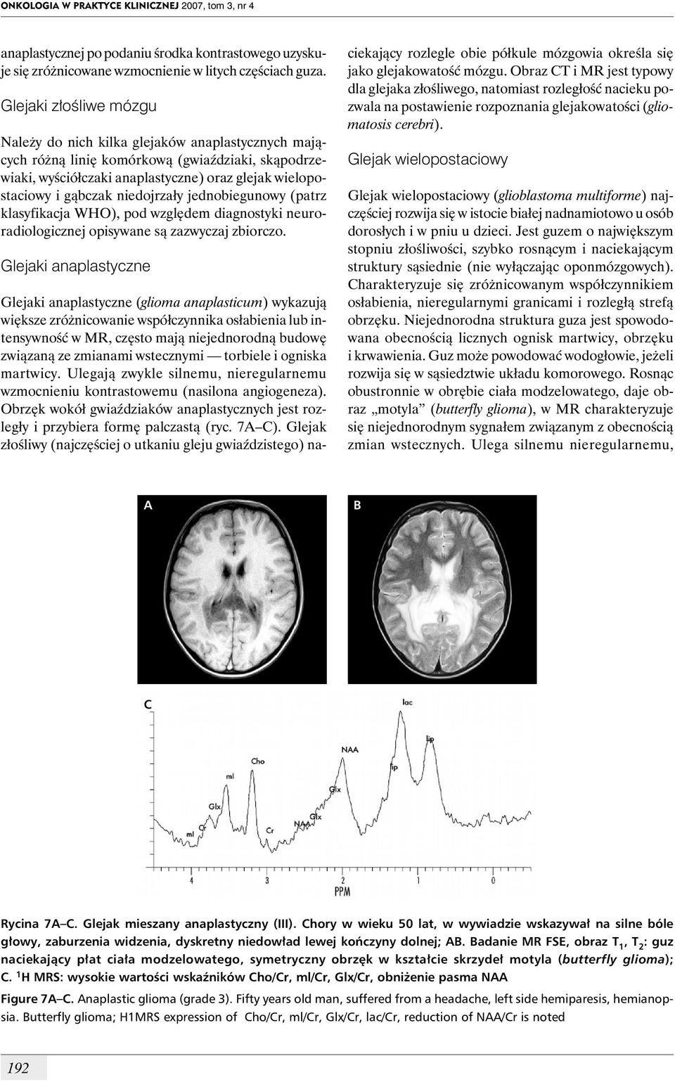 niedojrzały jednobiegunowy (patrz klasyfikacja WHO), pod względem diagnostyki neuroradiologicznej opisywane są zazwyczaj zbiorczo.