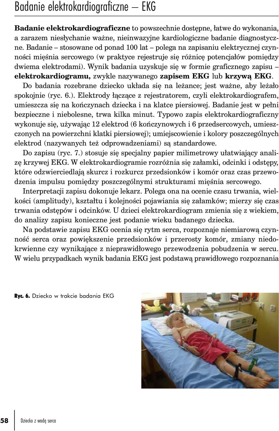 Wynik badania uzyskuje się w formie graficznego zapisu elektrokardiogramu, zwykle nazywanego zapisem EKG lub krzywą EKG.