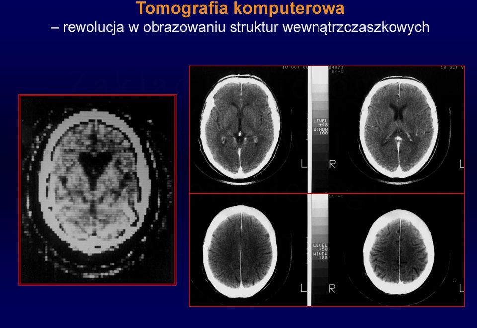 rewolucja w