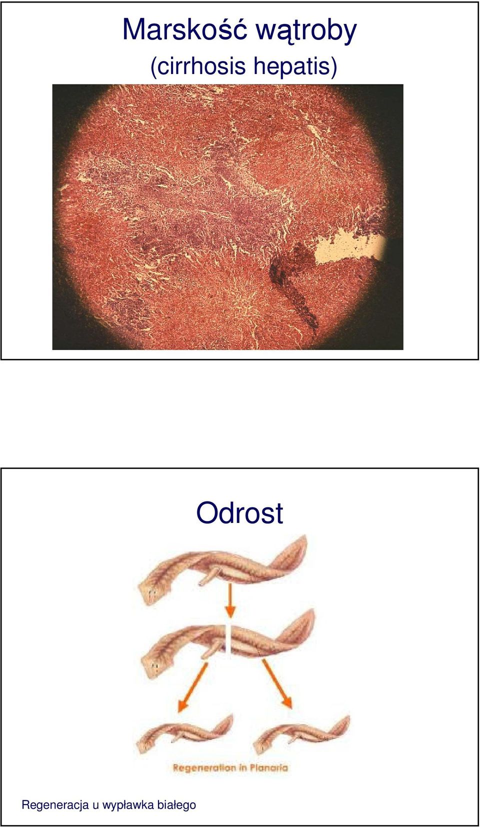 hepatis) Odrost