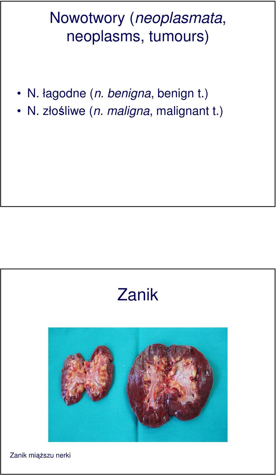 benigna, benign t.) N. złośliwe (n.