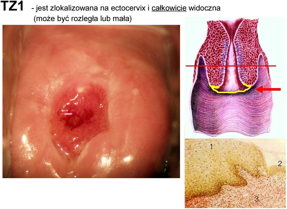 ectocervix i