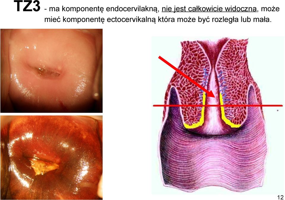 całkowicie widoczna, może mieć