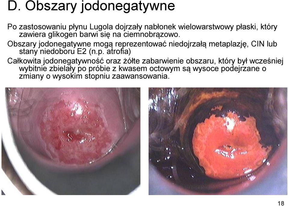 Obszary jodonegatywne mogą repr