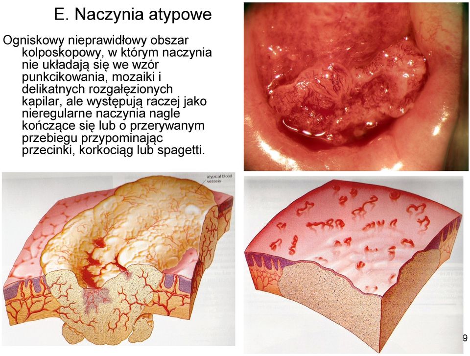 rozgałęzionych kapilar, ale występują raczej jako nieregularne naczynia nagle