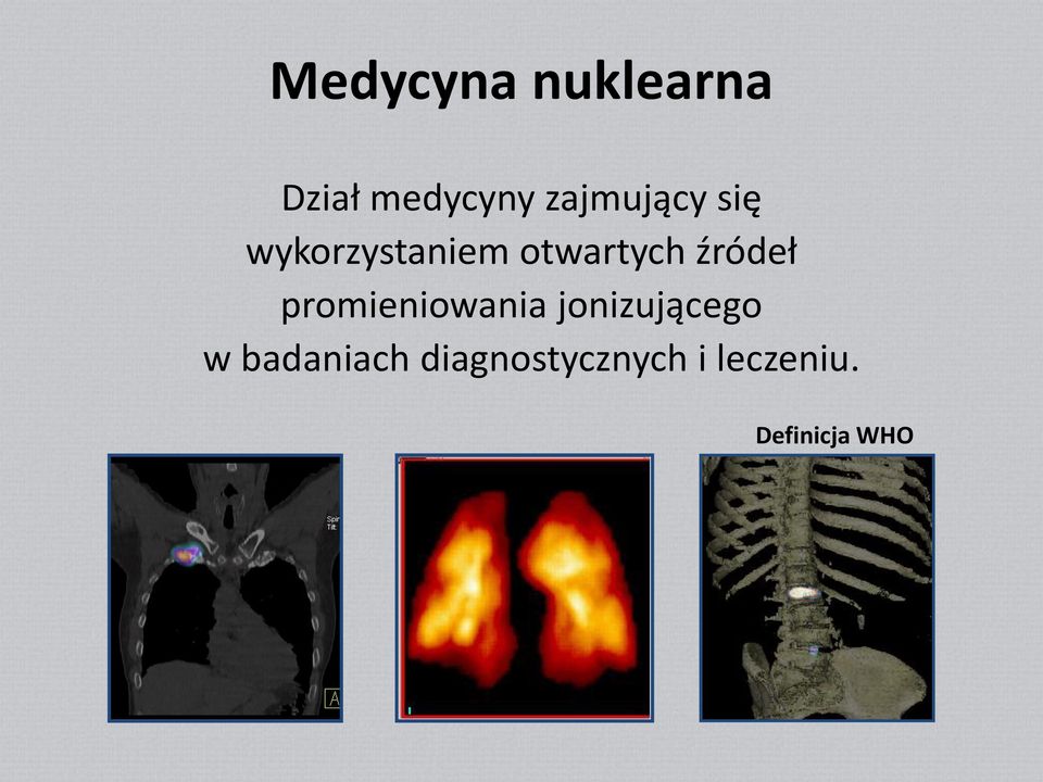 źródeł promieniowania jonizującego w