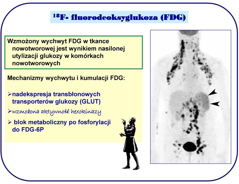 Mechanizmy wychwytu i kumulacji FDG: nadekspresja transbłonowych