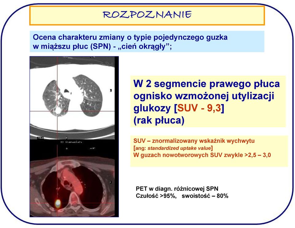 9,3] (rak płuca) SUV znormalizowany wskaźnik wychwytu [ang: standardized uptake value] W