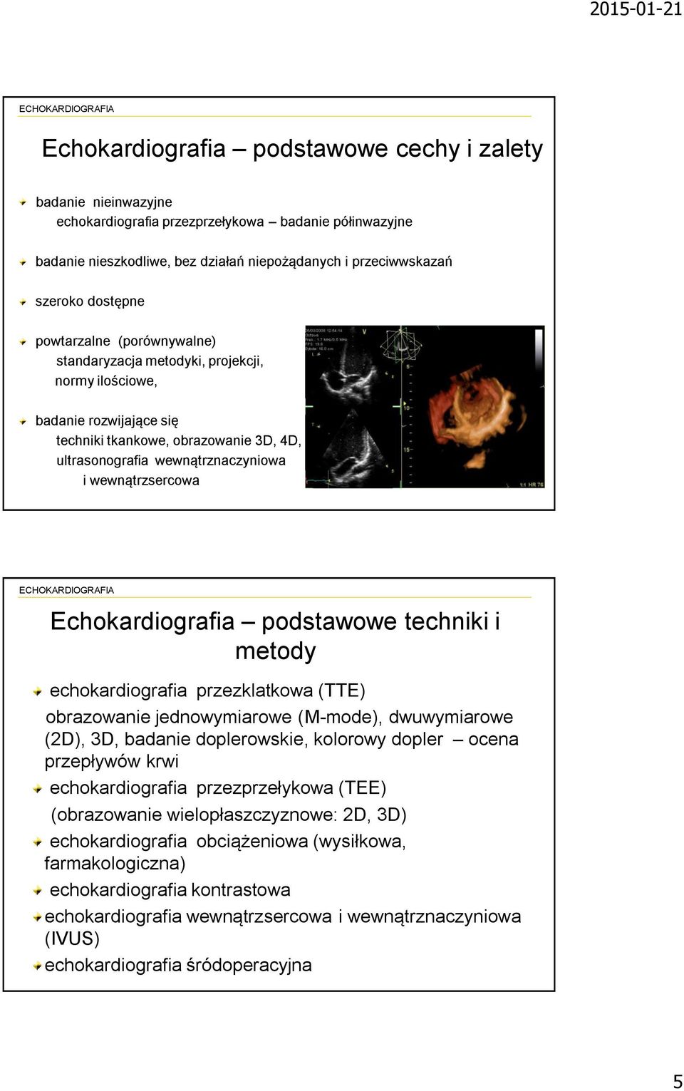 Echokardiografia podstawowe techniki i metody echokardiografia przezklatkowa (TTE) obrazowanie jednowymiarowe (M-mode), dwuwymiarowe (2D), 3D, badanie doplerowskie, kolorowy dopler ocena przepływów