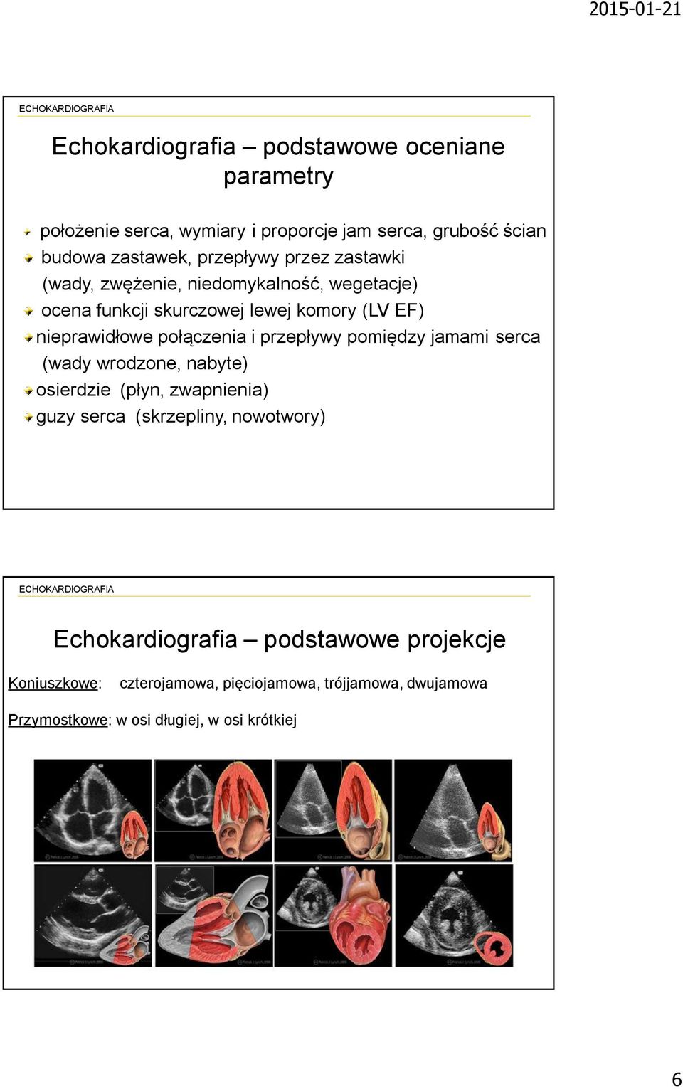 połączenia i przepływy pomiędzy jamami serca (wady wrodzone, nabyte) osierdzie (płyn, zwapnienia) guzy serca (skrzepliny, nowotwory)